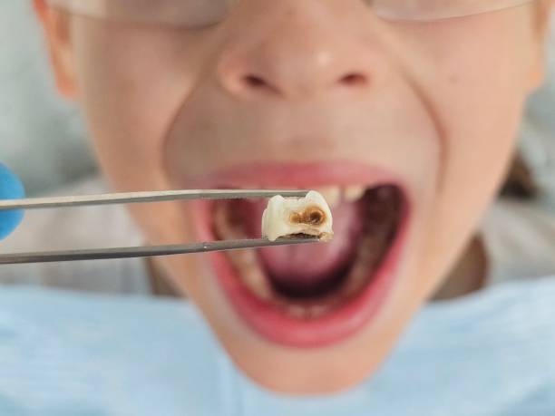 Best Tooth Infection Emergency Dentist  in Wyandanch, NY